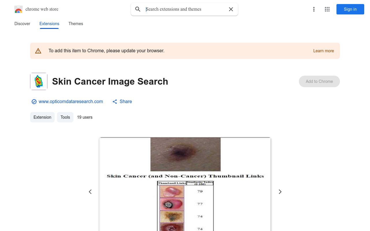 Skin Cancer Image Search
