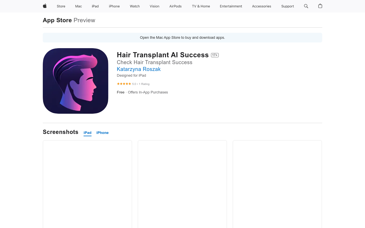 Hair Transplant AI Success